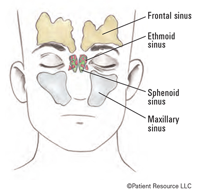 maxillary sinus cancer