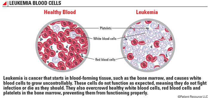 leukemia cells vs normal cells