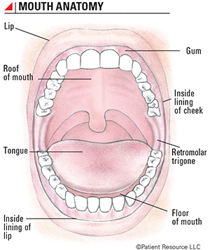 retromolar trigone swollen